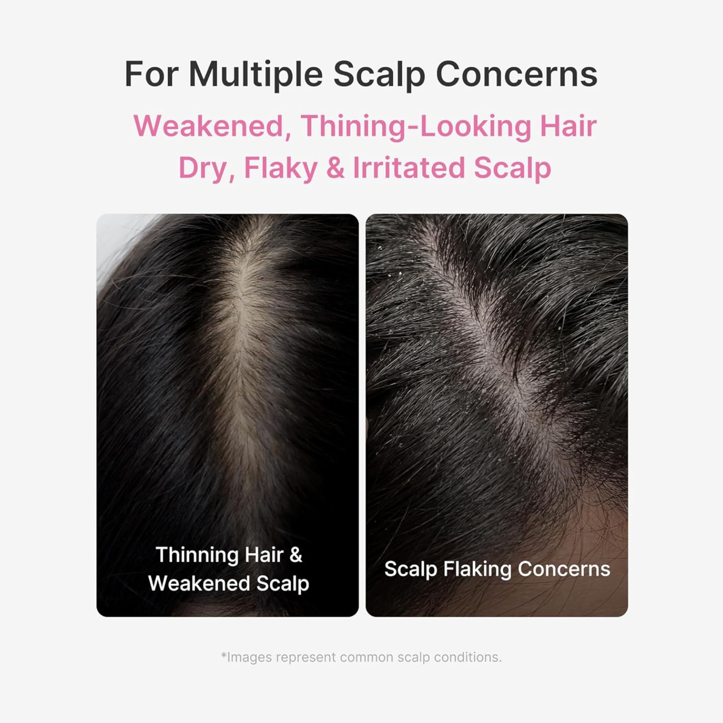 MEDICUBE Roseymary PDRN Scalp Serum 20ml