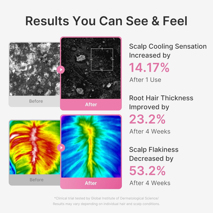 MEDICUBE Roseymary PDRN Scalp Serum 20ml