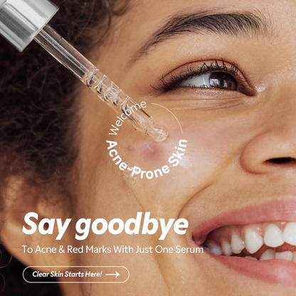 TIRTIR Azelaic Acid 12% Serum 30ml