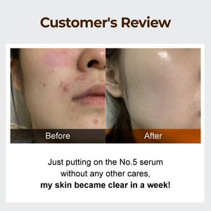 NUMBUZIN No.5 Goodbye Blemish Serum 50ml